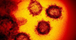 Covid, l’inchiesta di Report sul virus fornito dallo Spallanzani al Vector Institute del governo russo