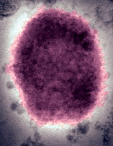 L’Organizzazione Mondiale della Sanità lancia un’emergenza globale per il vaiolo delle scimmie a causa dell’aumento dei casi