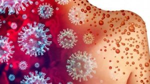 Vaiolo delle scimmie: dal contagio al vaccino, cosa c’è da sapere
