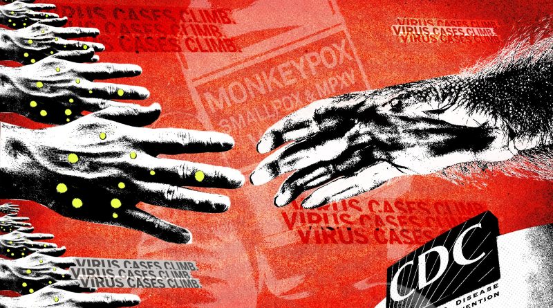 “A Hunger Games Contest”: How Unforced Errors Hobbled America’s Monkeypox Response