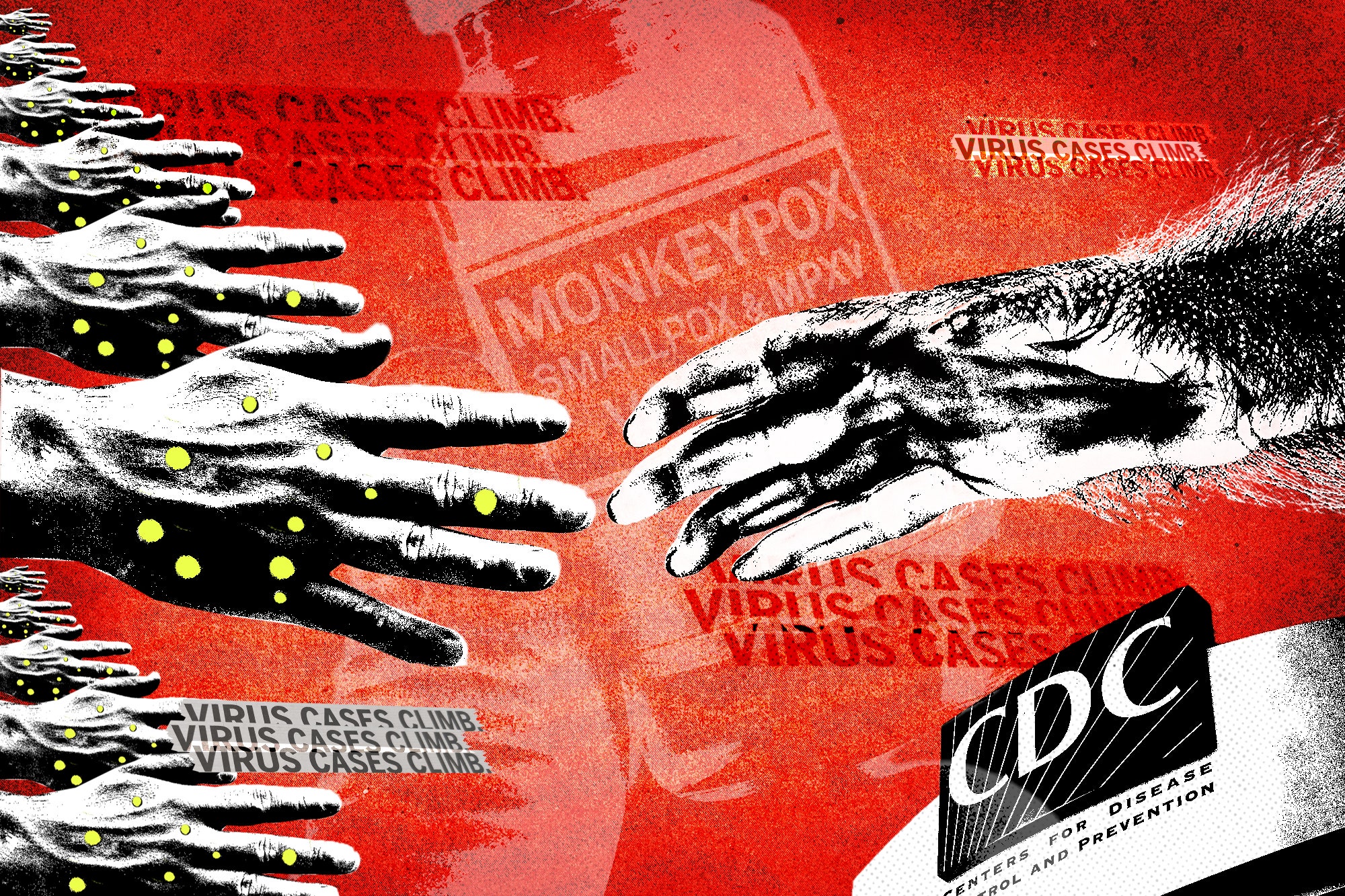 “A Hunger Games Contest”: How Unforced Errors Hobbled America’s Monkeypox Response