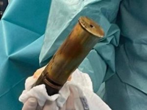 Arriva in ospedale con un proiettile d’artiglieria nel retto, allarme bomba