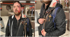 Milano, il presidente del “Comitato sicurezza” Matthia Pezzoni aggredito in metro durante la “ronda” anti-borseggiatori