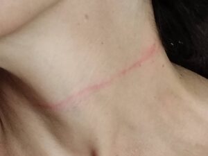 “Mi ha strappato la catenina, ero in trappola”. L’incubo di una studentessa a Milano