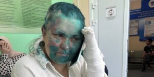 L’aggressione contro la giornalista russa Elena Milashina