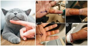 Accarezza un gatto randagio, questo lo muore e gli trasmette una malattia sconosciuta: ricoverato in ospedale, diventa un caso studio