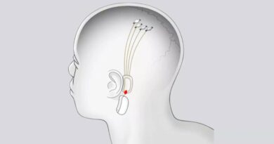 Neuralink apre le porte al futuro: aprono le iscrizioni per i test sugli umani