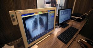 Così l’Ia entra in radiologia e “vede” dove l’occhio del medico non arriva: diagnosi più accurate