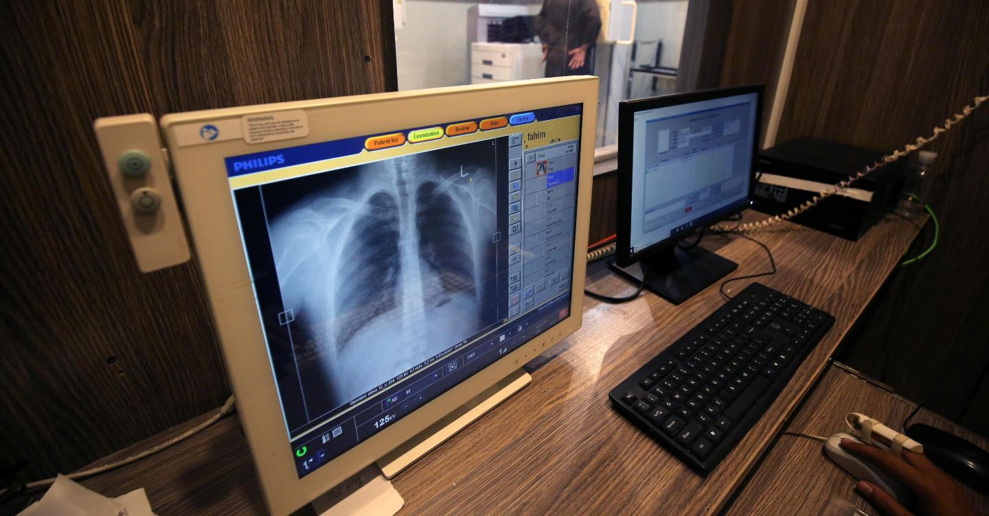 Così l’Ia entra in radiologia e “vede” dove l’occhio del medico non arriva: diagnosi più accurate