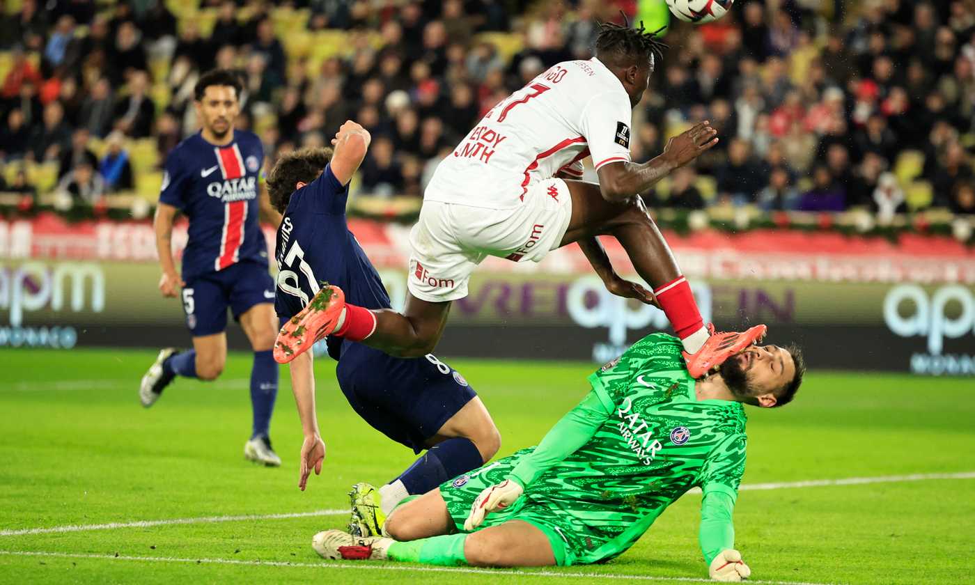 Donnarumma ko: tacchetti in faccia da Singo (solo ammonito) ed è costretto a uscire, punti sul volto sfigurati FOTO