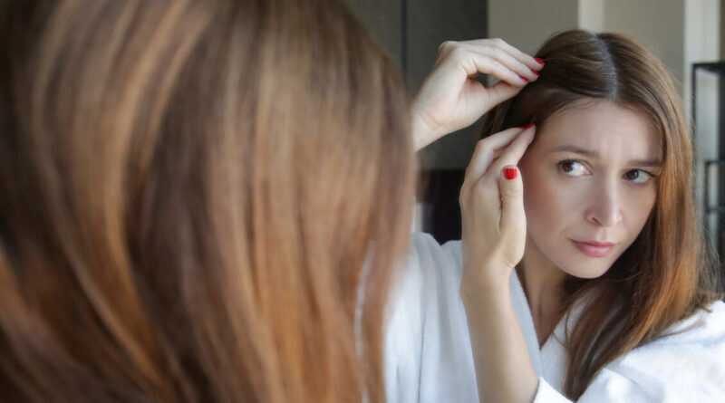 Alopecia, arriva la prima terapia orale per adulti e adolescenti