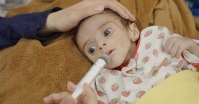 La mamma di una bimba emaciata a Gaza dice: “Ho perso mio marito… Non voglio perdere lei”