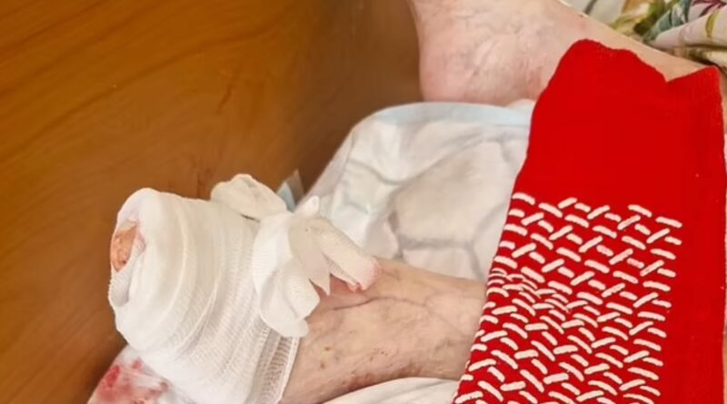 “Un topo ha mangiato un dito del piede a mia mamma, lei dormiva e non si è accorta di nulla. Siamo sotto choc”: la denuncia di Andrea Scott