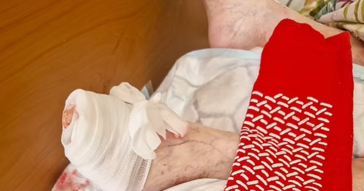“Un topo ha mangiato un dito del piede a mia mamma, lei dormiva e non si è accorta di nulla. Siamo sotto choc”: la denuncia di Andrea Scott