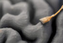 Nuova interfaccia cervello-computer consente a paziente con SLA di parlare in tempo reale